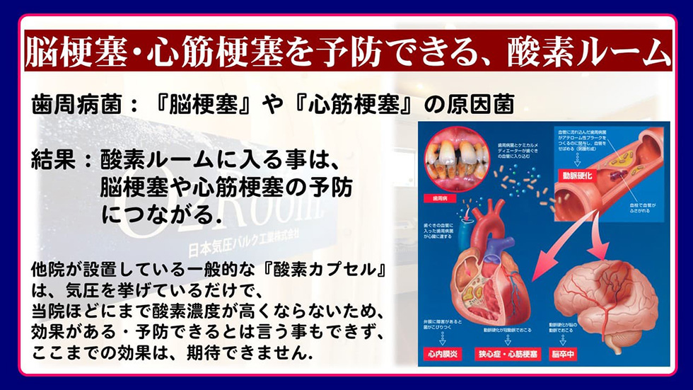 当整骨院にある酸素ルームで脳梗塞・心筋梗塞を予防