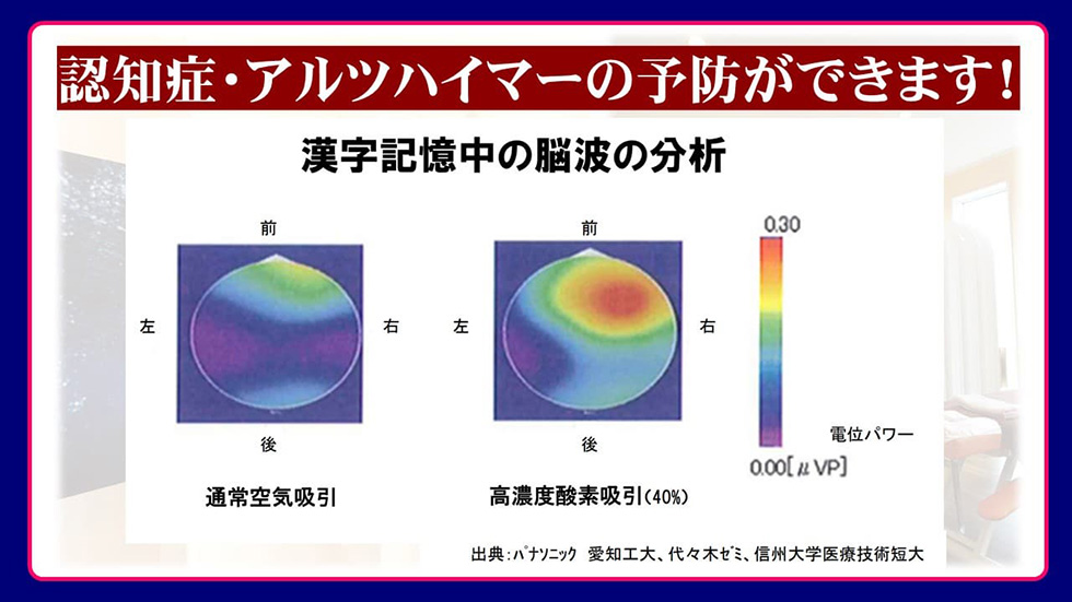 認知症・アルツハイマー型認知症予防